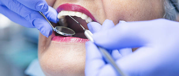 Best Emergency Dental Care for Broken or Chipped Teeth in Tooele, UT